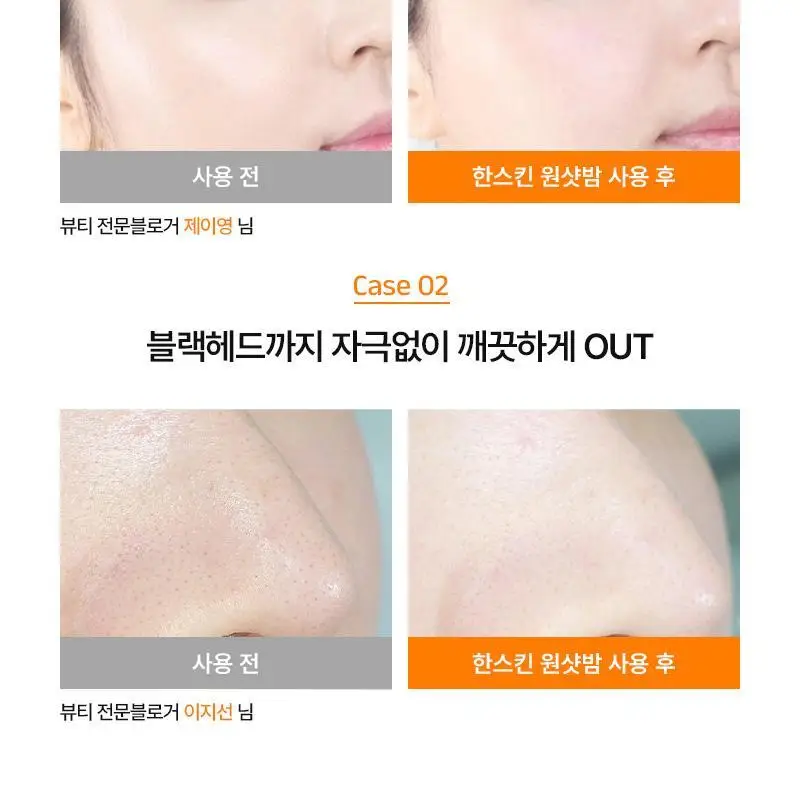 [퓨어디PICK/모공] 한스킨 딥 클렌징밤&블랙헤드 100ml 기획 (+15ml) 상세페이지 21
